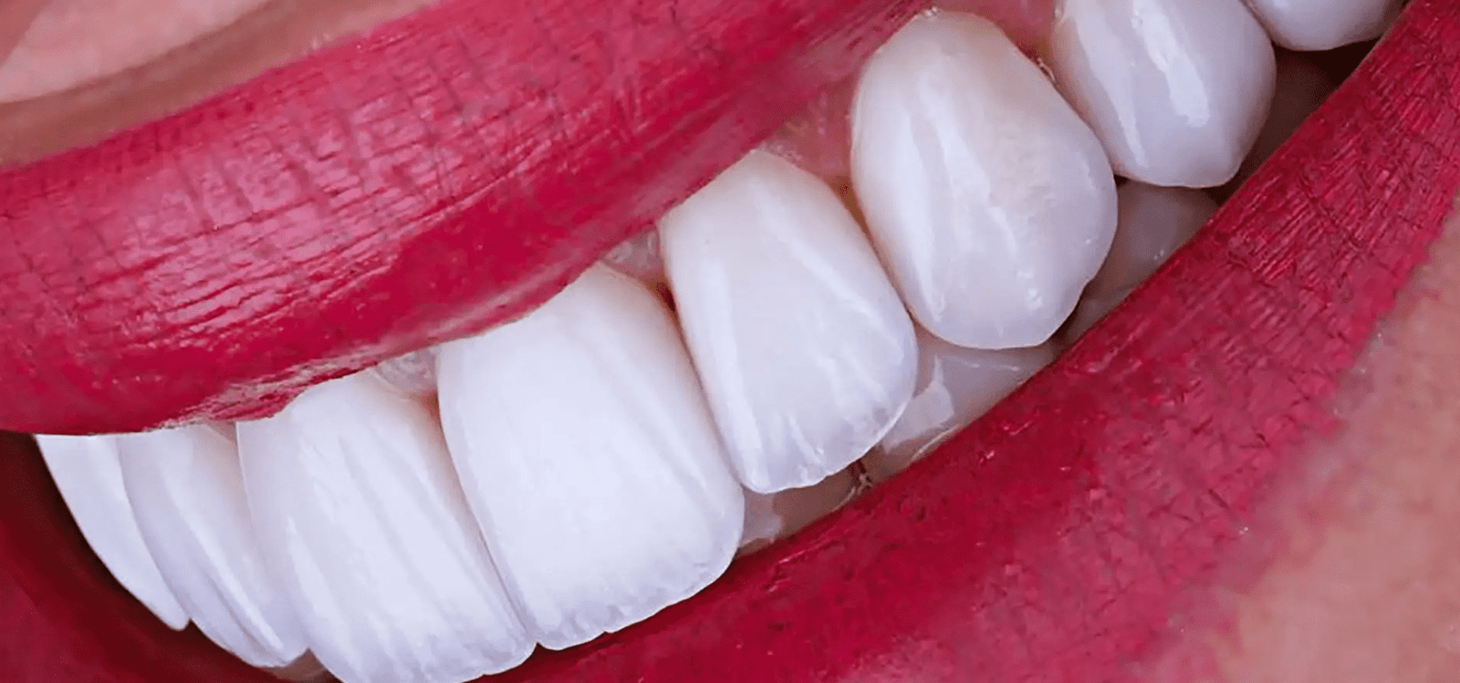 Trattamenti odontoiatrici: tipi, durata e sbiancamento dei denti